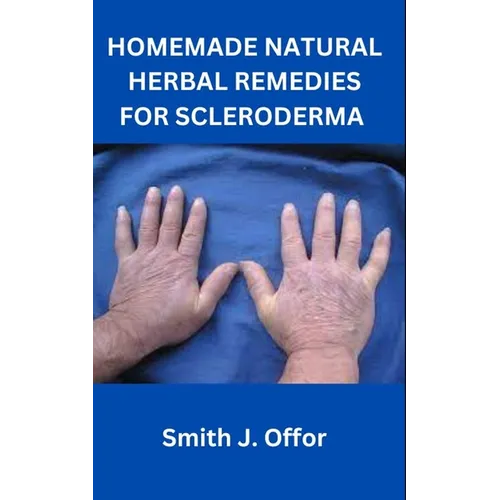 Homemade Natural Herbal Remedies for Scleroderma - Paperback