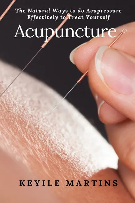 Acupuncture: The Natural Ways to do Acupressure Effectively to Treat Yourself - Paperback