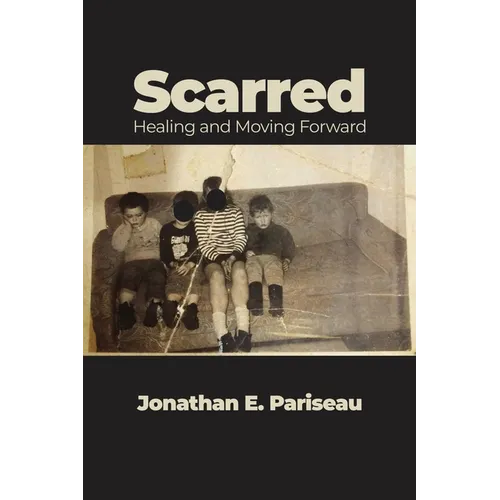 Scarred: Healing and Moving Forward - Paperback