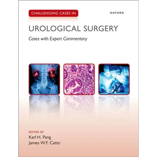 Challenging Cases in Urological Surgery - Paperback