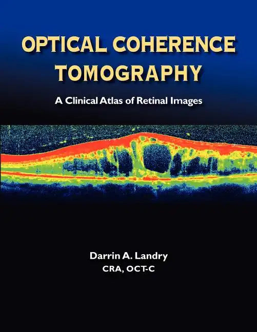 Optical Coherence Tomography a Clinical Atlas of Retinal Images - Paperback