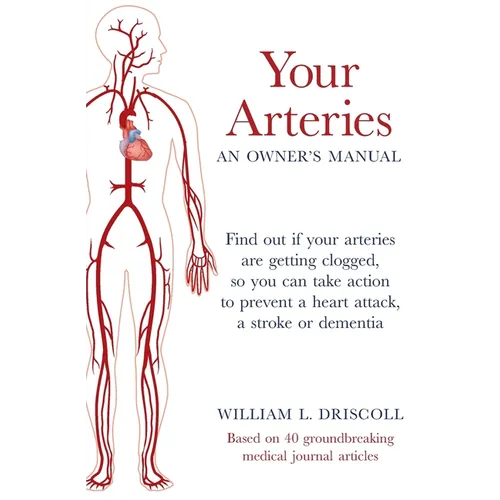 Your Arteries-An Owner's Manual: Find out if your arteries are getting clogged, so you can take action to prevent a heart attack, a stroke or dementia - Paperback
