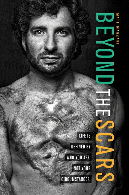 Beyond the Scars: Life Is Defined by Who You Are, Not Your Circumstances - Paperback