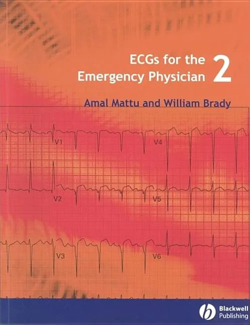 Ecgs for the Emergency Physician 2 - Paperback