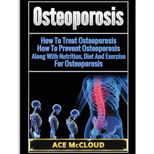 Osteoporosis: How To Treat Osteoporosis: How To Prevent Osteoporosis: Along With Nutrition, Diet And Exercise For Osteoporosis - Hardcover