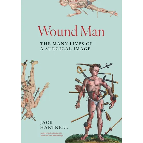 Wound Man: The Many Lives of a Surgical Image