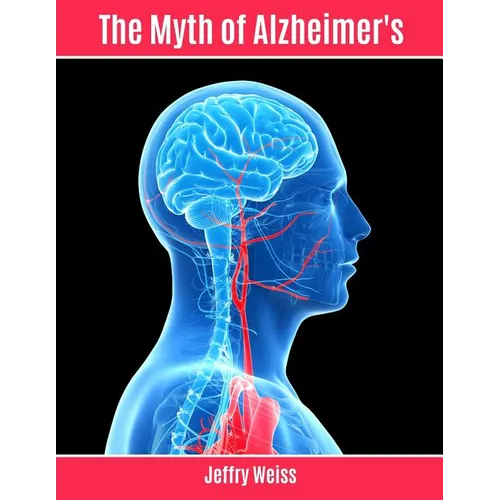 The Myth of Alzheimer's - Paperback