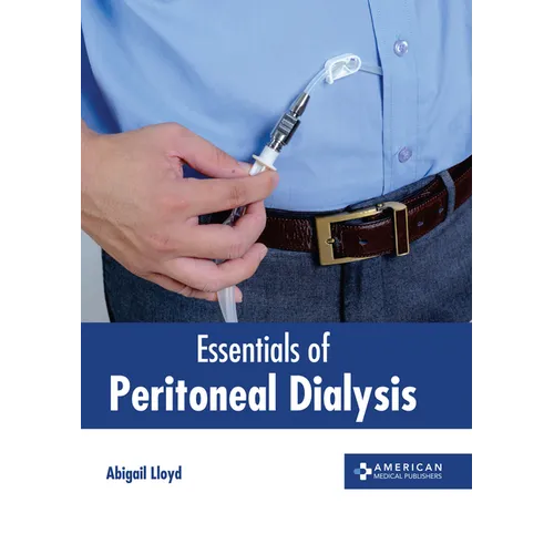 Essentials of Peritoneal Dialysis - Hardcover