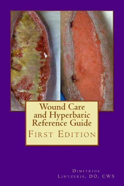 Wound Care and Hyperbaric Reference Guide - Paperback
