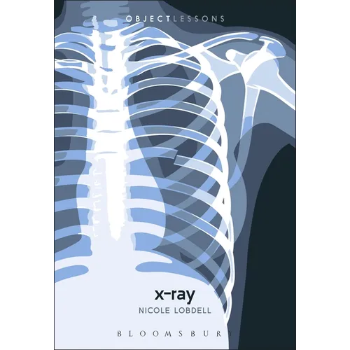 X-Ray - Paperback