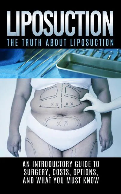 Liposuction: The Truth About Liposuction: An Introductory Guide to Surgery, Costs, Options, And What You Must Know - Paperback
