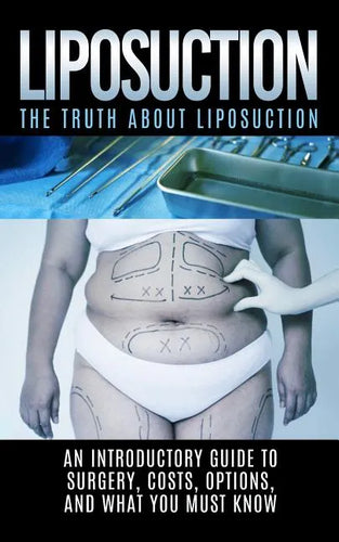 Liposuction: The Truth About Liposuction: An Introductory Guide to Surgery, Costs, Options, And What You Must Know - Paperback