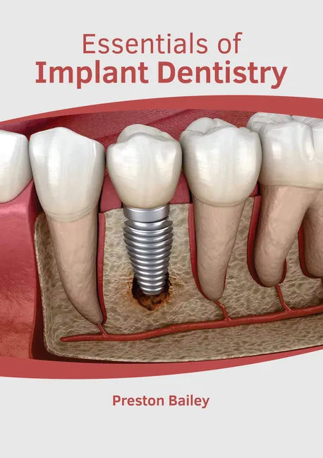 Essentials of Implant Dentistry - Hardcover