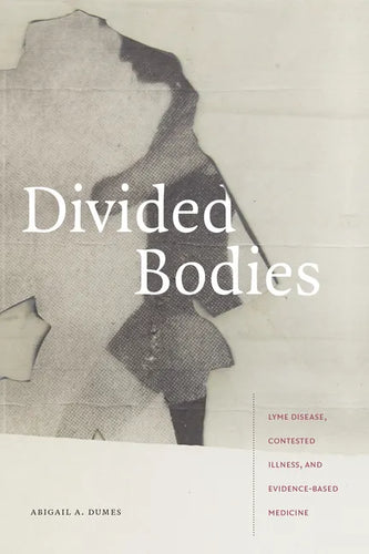Divided Bodies: Lyme Disease, Contested Illness, and Evidence-Based Medicine - Paperback