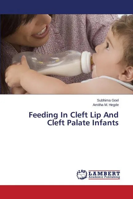 Feeding In Cleft Lip And Cleft Palate Infants - Paperback
