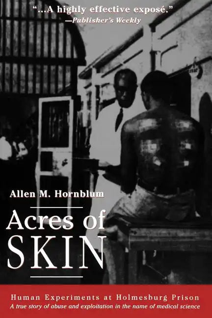 Acres of Skin: Human Experiments at Holmesburg Prison - Paperback