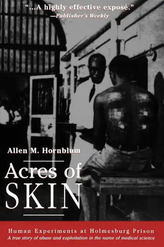 Acres of Skin: Human Experiments at Holmesburg Prison - Paperback