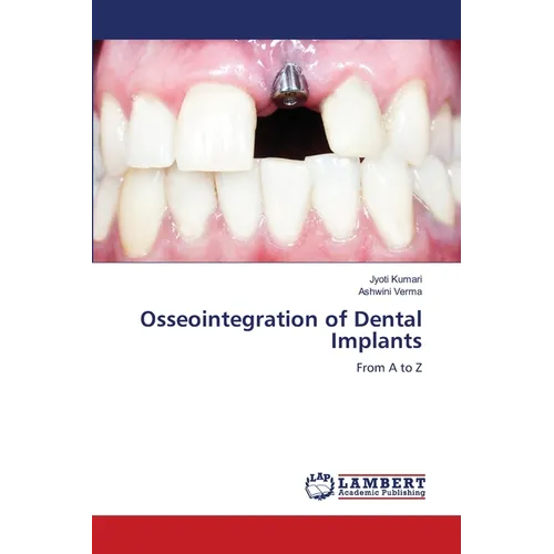 Osseointegration of Dental Implants - Paperback