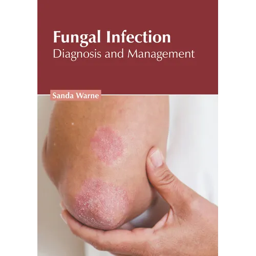 Fungal Infection: Diagnosis and Management - Hardcover