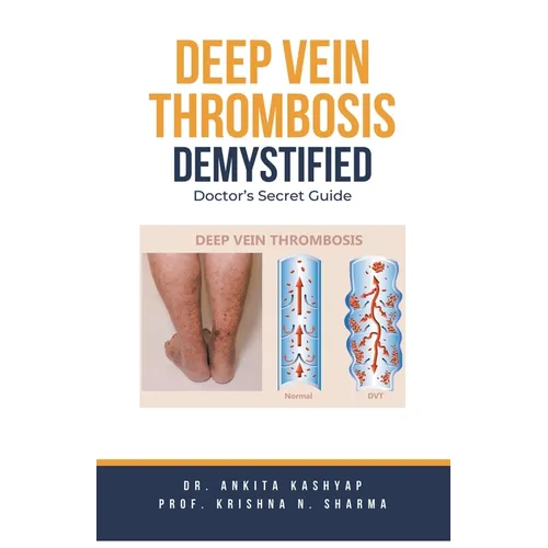 Deep Vein Thrombosis Demystified: Doctor's Secret Guide - Paperback