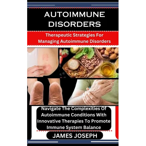 Autoimmune Disorders: Therapeutic Strategies For Managing Autoimmune Disorders: Navigate The Complexities Of Autoimmune Conditions With Inno - Paperback