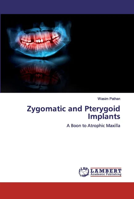 Zygomatic and Pterygoid Implants - Paperback
