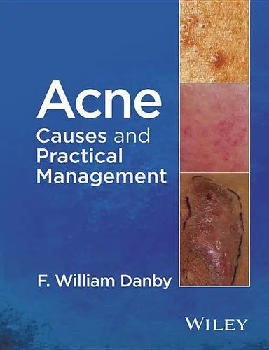 Acne: Causes and Practical Management - Hardcover