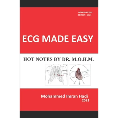 ECG Made Easy: Hot Notes by Dr. M.O.H.M. - Paperback