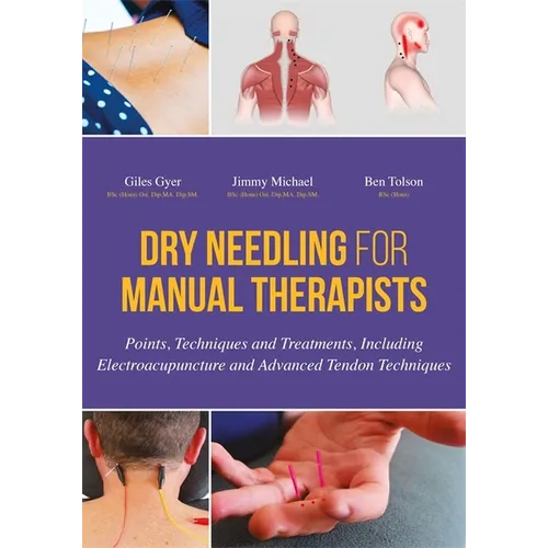 Dry Needling for Manual Therapists: Points, Techniques and Treatments, Including Electroacupuncture and Advanced Tendon Techniques - Hardcover