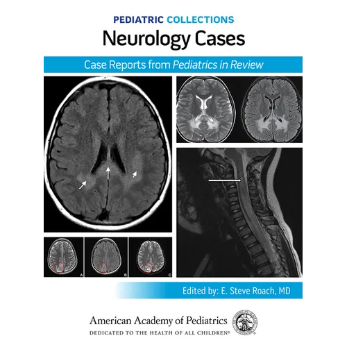 Pediatric Collections: Neurology Cases: Case Reports from Pediatrics in Review - Paperback