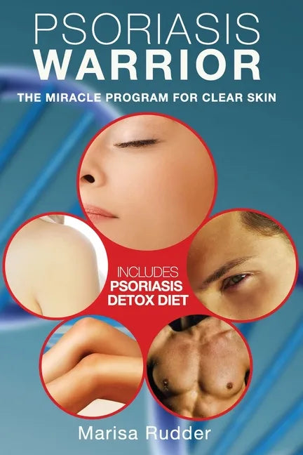 Psoriasis Warrior: The Miracle Program for Clear skin - Paperback
