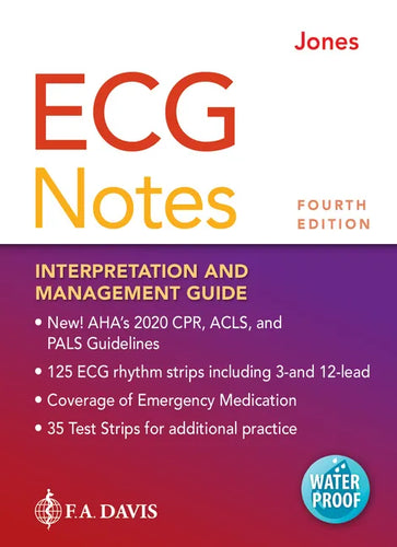 ECG Notes: Interpretation and Management Guide - Spiral