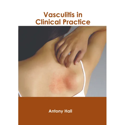 Vasculitis in Clinical Practice - Hardcover
