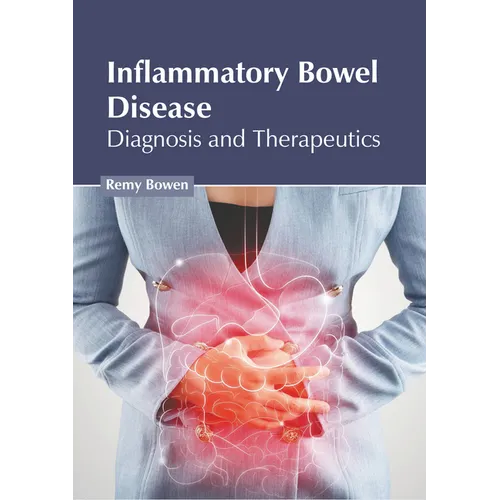 Inflammatory Bowel Disease: Diagnosis and Therapeutics - Hardcover