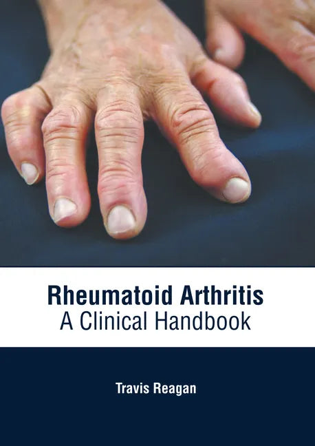 Rheumatoid Arthritis: A Clinical Handbook - Hardcover