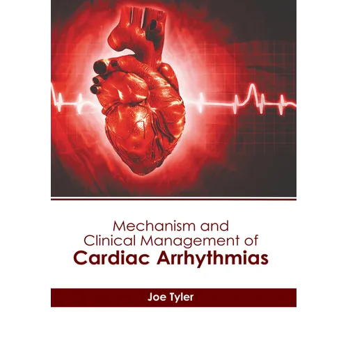 Mechanism and Clinical Management of Cardiac Arrhythmias - Hardcover
