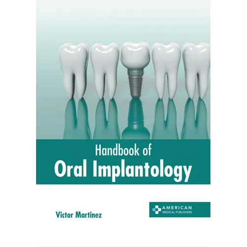Handbook of Oral Implantology - Hardcover