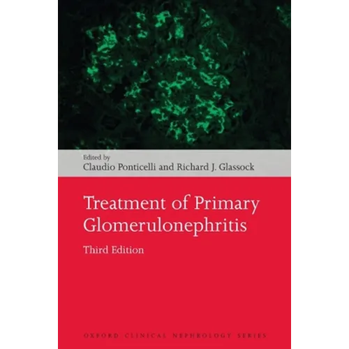 Treatment of Primary Glomerulonephritis - Paperback