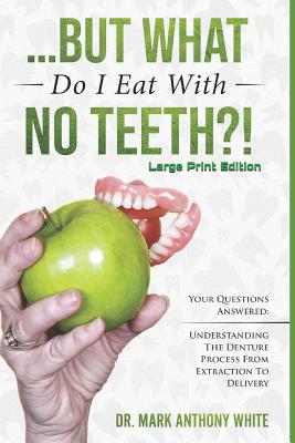 ... But What Do I Eat with No Teeth?! Your Questions Answered: Understanding the Denture Process from Extraction to Delivery: Large Print - Paperback