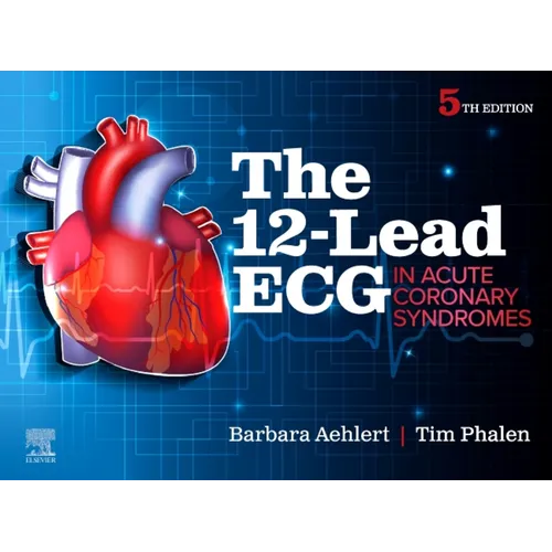 The 12-Lead ECG in Acute Coronary Syndromes - Paperback