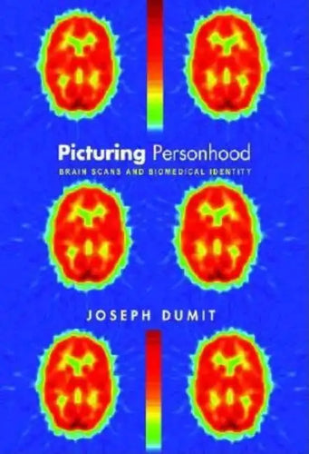 Picturing Personhood: Brain Scans and Biomedical Identity - Paperback