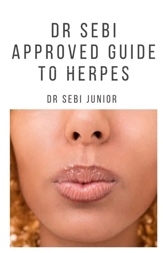 Dr Sebi Approved Guide to Herpes: Includes natural remedy, how to manage and everything you need to know about herpes - Paperback