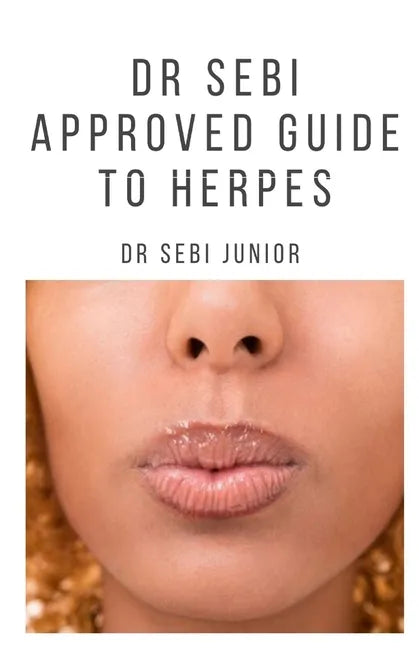 Dr Sebi Approved Guide to Herpes: Includes natural remedy, how to manage and everything you need to know about herpes - Paperback