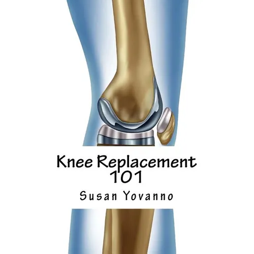 Knee Replacement 101: A User's Guide to Preparation for and Recovery After Knee Arthroplasty - Paperback