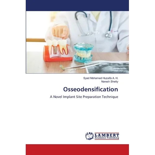 Osseodensification - Paperback