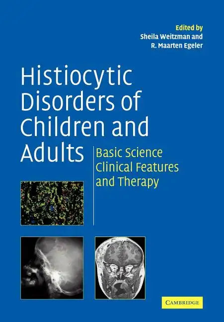 Histiocytic Disorders of Children and Adults: Basic Science, Clinical Features and Therapy - Paperback
