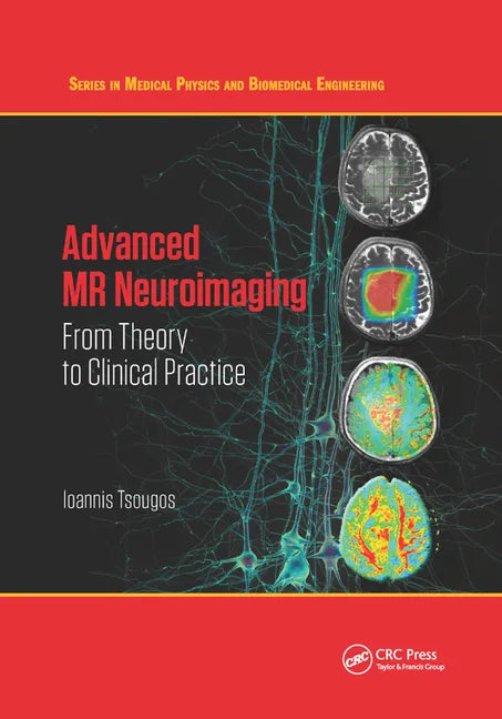 Advanced MR Neuroimaging: From Theory to Clinical Practice - Paperback
