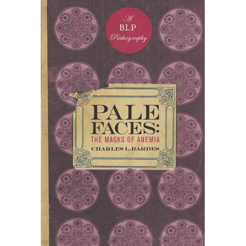 Pale Faces: The Masks of Anemia - Hardcover