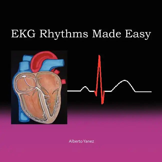 EKG Rhythms Made Easy - Paperback