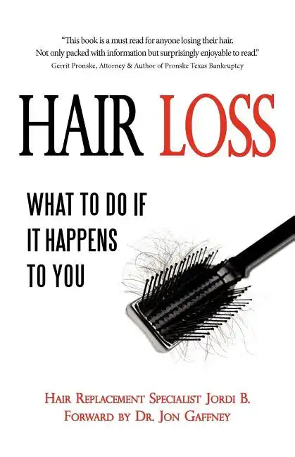 Hair Loss: What to do if it Happens to You - Paperback